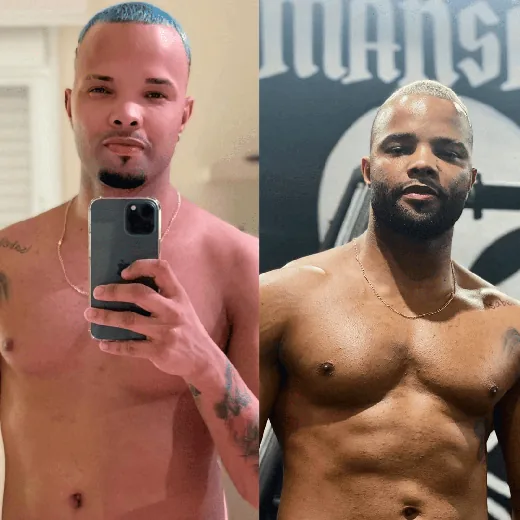 Antes e depois de MC Zaac com o Método Linares